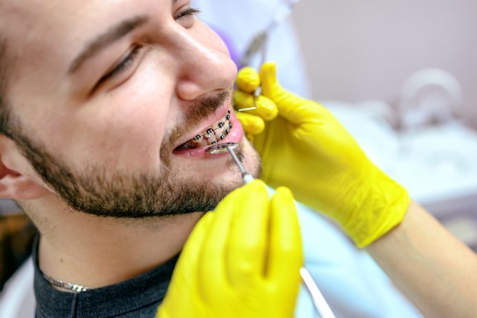 Young man at orthodontist getting braces checked