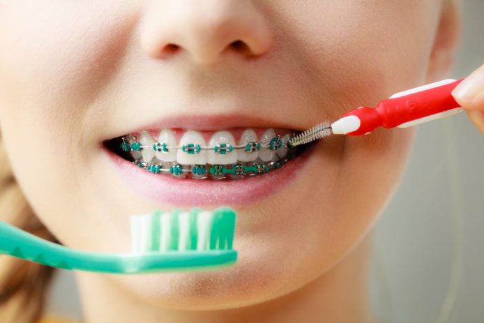 Girl cleaning her braces