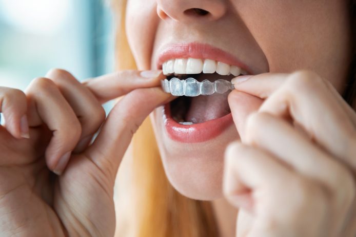 Close up of woman putting Invisalign on teeth
