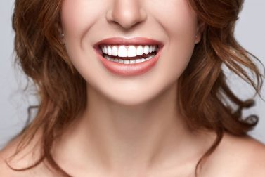Woman with perfectly straight, white teeth