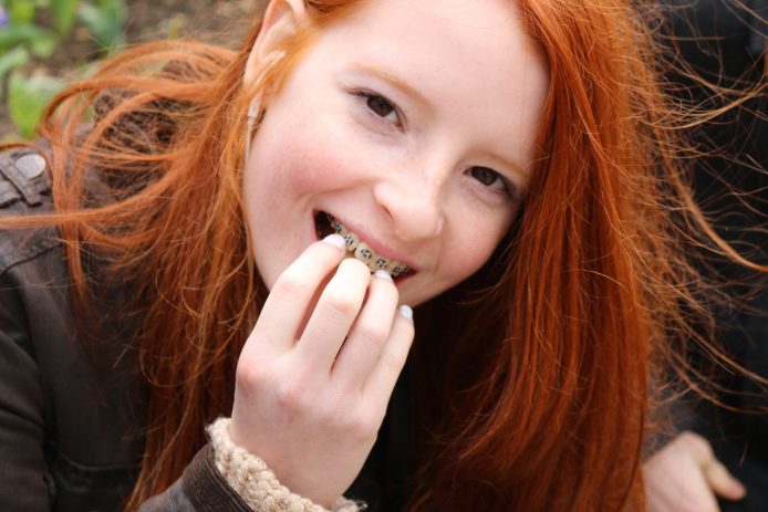 Teenager eating with braces