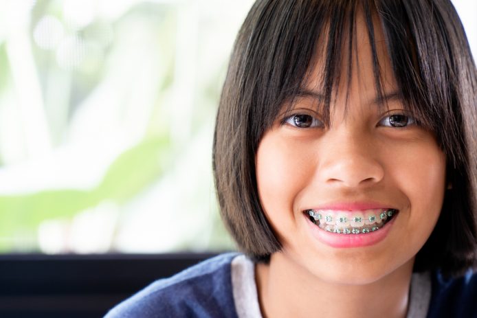 Girl with braces smiling