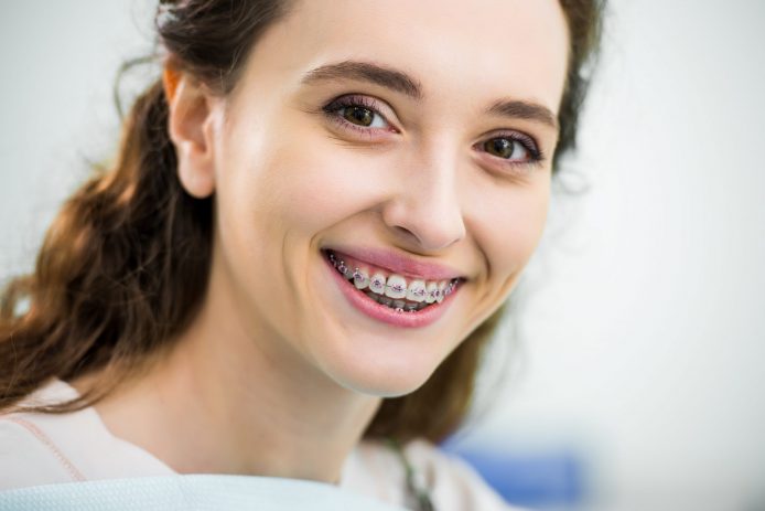 Young brunette woman smiling with metal braces