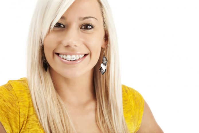 A young blonde woman smiles with braces